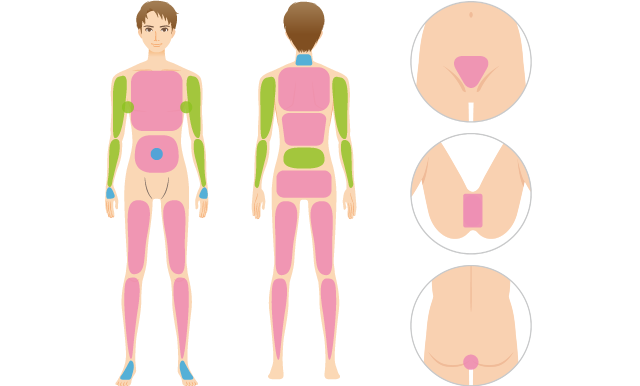 全身脱毛のサービス