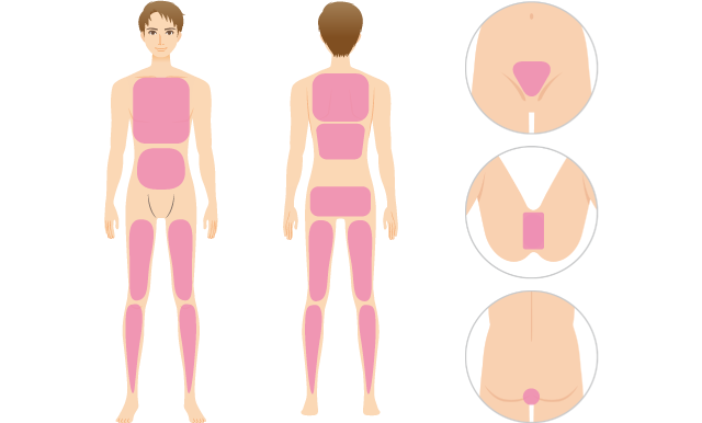 パーツ脱毛のサービス