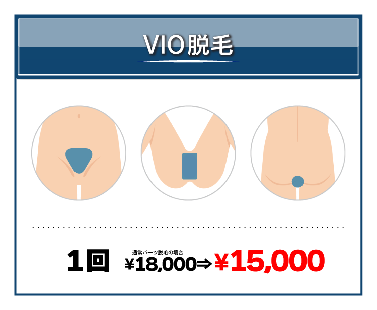 VIO脱毛のサービス